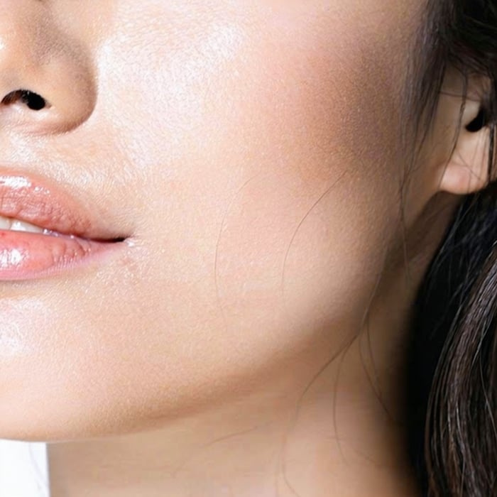 Chin and Cheeks (Mesolipo) image